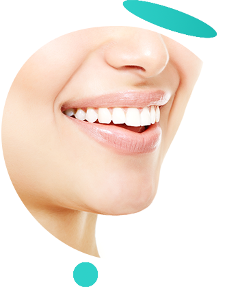 service whitening