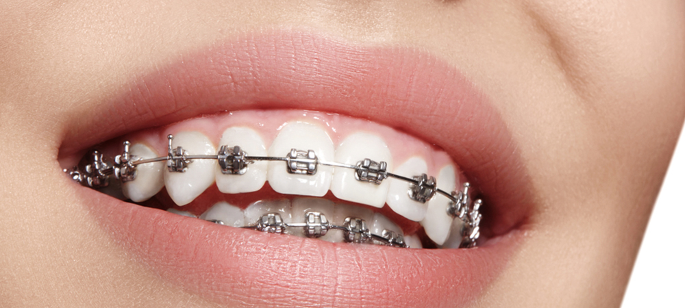 Dental Services