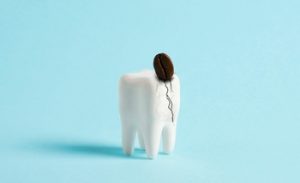 preventing cracked tooth albany