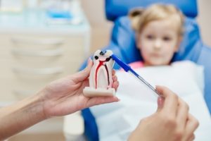 remedies for cracked tooth albany
